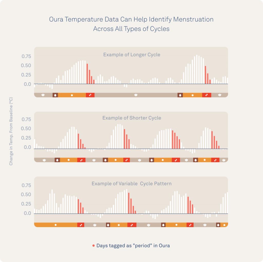 Oura Ring Temperature Data Can Help Identify Menstruation Across All Types of Cycles